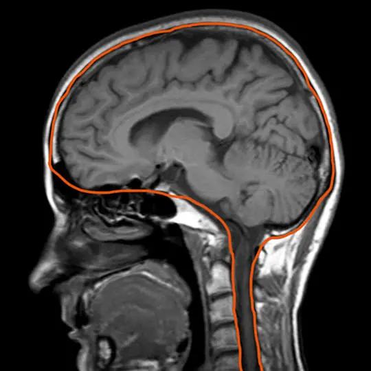 Risonanza magnetica del cranio