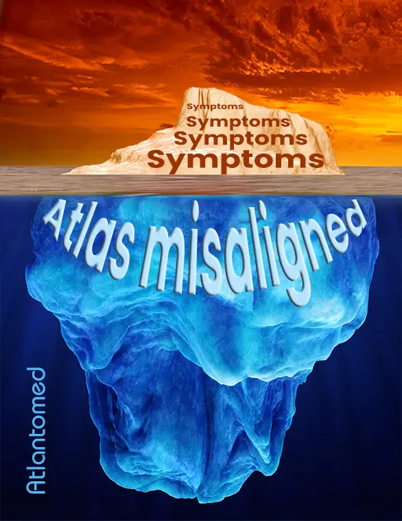 Symptoms of Atlas misalignment